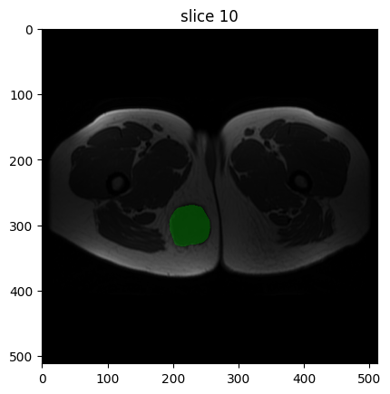 _images/tutorial_compute_radiomics_features_mr_8_0.png